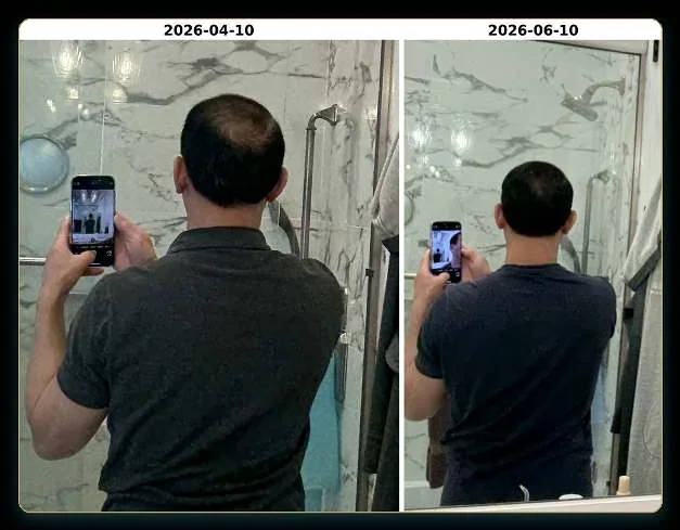 Second view of the same case, April to June 2026