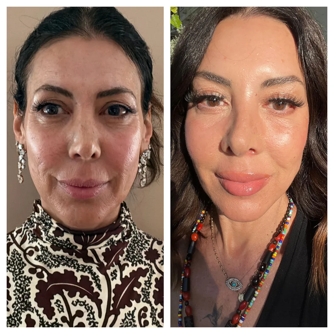 Facial skin before and after, April 2026